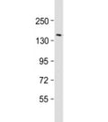 Western blot testing of human brain lysate with RTN4 antibody at 1:2000. Predicted molecular weight ~130 kDa but may be observed at up to ~220 kDa.