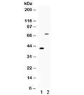 Western blot testing of 1) mouse testis and 2) mouse NIH3T3 lysate with Cd46 antibody. Observed molecular weight: 41~70 kDa depending on glycosylation level.