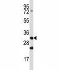 Cathepsin Q antibody western blot analysis in mouse spleen tissue lysate