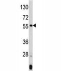 Western blot analysis of ANGPTL3 antibody and mouse liver tissue lysate. Expected molecular weight 50 ~ 63 kDa depending on glycosylation level.