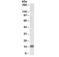 Western blot testing of human uterus lysate with IGF1 antibody at 0.5ug/ml. Predicted molecular weight ~15 kDa.