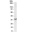 Western blot testing of rat heart lysate with ATP5C1 antibody at 0.01ug/ml. Predicted/observed molecular weight: ~33kDa.