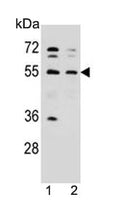 Western blot testing of human 1) WiDr and 2) HepG2 cell lysate with NARS antibody. Predicted molecular weight ~63 kDa.