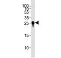 Western blot analysis of tagged protein lysate using GFP antibody at 1:4000.