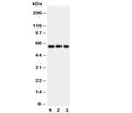 Western blot testing of HEXA antibody and Lane 1: rat liver; 2: human HeLa; 3: (h) SMMC-7721 cell lysate. Expected molecular weight: ~60 kDa (precursor), ~54 kDa (mature).