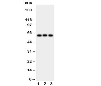 Western blot testing of HEXA antibody and Lane 1: rat liver; 2: human HeLa; 3: (h) SMMC-7721 cell lysate. Expected molecular weight: ~60 kDa (precursor), ~54 kDa (mature).