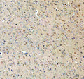 Immunohistochemical staining of SEZ6L2 using anti-SEZ6L2 antibody. SEZ6L2 was detected in a paraffin-embedded section of human testis tissue. Heat mediated antigen retrieval was performed in EDTA buffer (pH 8.0, epitope retrieval solution). The tissue section was blocked with 10% goat serum. The tissue section was then incubated with 2 ug/ml rabbit anti-SEZ6L2 antibody overnight at 4oC. Peroxidase Conjugated Goat Anti-rabbit IgG was used as secondary antibody and incubated for 30 min at 37oC.