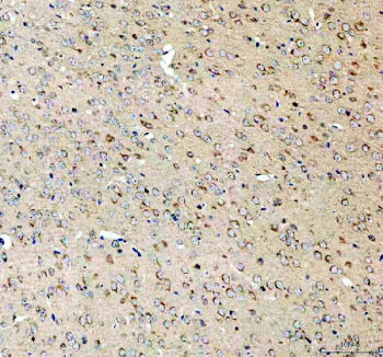 Immunohistochemical staining of SEZ6L2 using anti-SEZ6L2 antibody. SEZ6L2 was detected in a paraffin-embedded section of human testis tissue. Heat mediated antigen retrieval was performed in EDTA buffer (pH 8.0, epitope retrieval solution). The tissue section was blocked with 10% goat serum. The tissue section was then incubated with 2 ug/ml rabbit anti-SEZ6L2 antibody overnight at 4oC. Peroxidase Conjugated Goat Anti-rabbit IgG was used as secondary antibody and incubated for 30 min at 37oC.