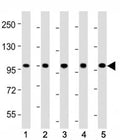 Western blot testing of LGR-5 antibody at 1:2000 dilution. Lane 1: mouse skeletal muscle; 2: rat skeletal muscle; 3: HeLa; 4: HepG2; 5: SH-SY5Y lysate; Predicted band size : 100 kDa.