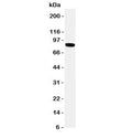 Western blot testing of TRPV2 antibody and HeLa cell lysate. Expected molecular weight: 85-95 kDa depending on glycosylation level.
