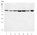Western blot testing of 1) rat brain, 2) rat kidney, 3) rat heart, 4) rat RH35, 5) mouse brain, 6) mouse heart and 7) mouse C2C12 cell lysate with Rsl1d1 antibody. Predicted molecular weight ~55 kDa, commonly observed at 55-70 kDa.