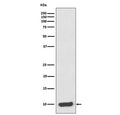 Western blot testing of human HeLa cell lysate with S100A6 antibody. Predicted molecular weight ~10 kDa.