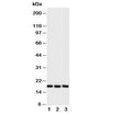 Western blot testing of I-309 antibody and Lane 1: SCG; 2: COLO320; 3: Jurkat cell lysate. Expeced size ~11KD, observed size ~17KD