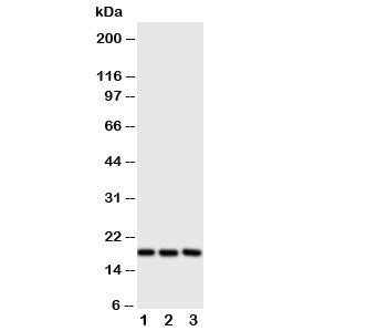 Western blot testing of I-309 antibody and Lane 1: SCG; 2: COLO320; 3: Jurkat cell lysate. Expeced size ~11KD, observed size ~17KD