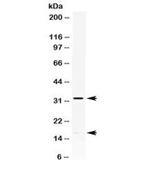 Western blot testing of HeLa cell lysate with IL-8 antibody. Expected molecular weight: ~8 kDa (monomer), ~16 kDa (dimer), ~32 kDa (oligomer).