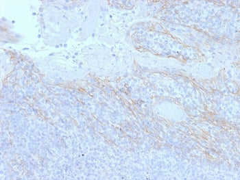 IHC testing of FFPE human tonsil tissue with Beta Catenin antibody (clone CTNNB1/2098). HIER: boil tissue sections in pH6, 10mM citrate buffer, for 10-20 min followed by cooling at RT for 20 min.