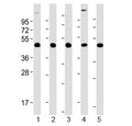 Western blot testing of human 1) brain, 2) K562, 3) Jurkat, 4) HepG2 and 5) A431 lysate with TSG101 antibody at 1:2000. Predicted molecular weight ~45 kDa.