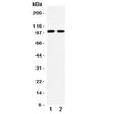 Western blot testing of GLUR3 antibody and Lane 1: rat brain; 2: mouse brain lysate. Predicted/observed size ~99KD