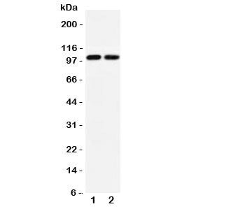 Western blot testing of GLUR3 antibody and Lane 1: rat brain; 2: mouse brain lysate. Predicted/observed size ~99KD