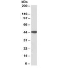 Western blot testing of human kidney lysate with AMACR antibody at 0.1ug/ml. Predicted molecular weight ~43kDa.
