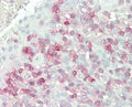 IHC testing of FFPE human tonsil tissue with FKBP10 antibody. HIER: steam section in pH6 citrate buffer for 20 min and allow to cool prior to staining.