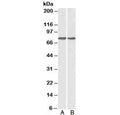 Western blot testing of A) HepG2 and B) MCF7 cell lysate with GRP78 antibody at 0.1ug/ml. Predicted molecular weight: ~73 kDa, but routinely observed at 70-78 kDa.