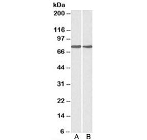 Western blot testing of A) HepG2 and B) MCF7 cell lysate with GRP78 antibody at 0.1ug/ml. Predicted molecular weight: ~73 kDa, but routinely observed at 70-78 kDa.
