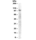 Western blot testing of A549 lysate with FGFR2 antibody at 0.3ug/ml. Predicted molecular weight of multiple isoforms: 80-120 kDa. The observed size may be larger due to glycosylation.