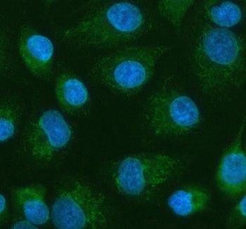 Western blot testing of PDK2 antbody on Lane 1: rat heart; 2: HeLa; 3: SW620; 4: MCF-7 cell lysate. Predicted molecular weight ~46 kDa.