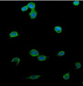 Immunofluorescent staining of FFPE human U-2 OS cells with Patched 2 antibody (green) and DAPI nuclear stain (blue). HIER: steam section in pH6 citrate buffer for 20 min.