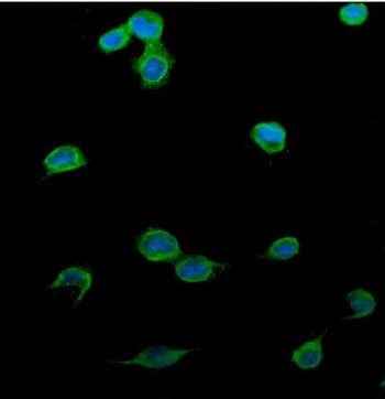 Immunofluorescent staining of FFPE human U-2 OS cells with Patched 2 antibody (green) and DAPI nuclear stain (blue). HIER: steam section in pH6 citrate buffer for 20 min.