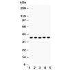 Western blot testing of KLF6 antibody and Lane 1: human placenta; 2: rat testis; 3: (h) HeLa; 4: (h) HEPG2; 5: mouse HEPA lysate. Expected size: 32~40KD