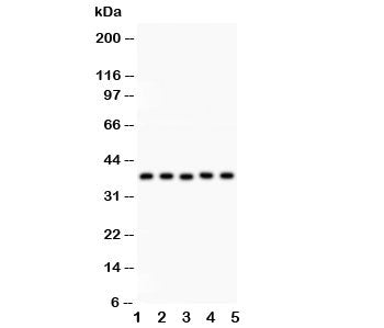 Western blot testing of KLF6 antibody and Lane 1: human placenta; 2: rat testis; 3: (h) HeLa; 4: (h) HEPG2; 5: mouse HEPA lysate. Expected size: 32~40KD