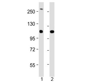 Western blot testing of 1) human SH-SY5Y and 2) mouse Neuro-2a cell lysate with NF-H antibody at 1:2000. Predicted molecular weight ~112 kDa, often visualized at ~200 kDa.