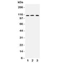 Western blot testing of human 1) COLO320, 2) MCF-7 and 3) PANC lysate with TRPC4 antibody at 0.5ug/ml. Predicted molecular weight: ~112 kDa.