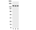 Western blot testing of TRKC antibody on Lane 1: rat brain; 2: mouse brain; 3: human U87 cell lysate. Observed molecular weight 95~145 kDa depending on glycosylation level.