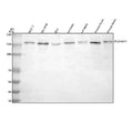 Western blot analysis of PCDHA11 using anti-PCDHA11 antibody. Lane 1: human MCF-7 whole cell lysates, Lane 2: human SH-SY5Y whole cell lysates, Lane 3: human RT4 whole cell lysates, Lane 4: rat brain tissue lysates, Lane 5: rat testis tissue lysates, Lane 6: mouse brain tissue lysates, Lane 7: mouse testis tissue lysates. After electrophoresis, proteins were transferred to a nitrocellulose membrane at 150 mA for 50-90 min. Blocked the membrane with 5% non-fat milk/TBS for 1.5 hour at RT.