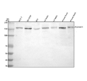 Western blot analysis of PCDHA11 using anti-PCDHA11 antibody. Lane 1: human MCF-7 whole cell lysates, Lane 2: human SH-SY5Y whole cell lysates, Lane 3: human RT4 whole cell lysates, Lane 4: rat brain tissue lysates, Lane 5: rat testis tissue lysates, Lane 6: mouse brain tissue lysates, Lane 7: mouse testis tissue lysates. After electrophoresis, proteins were transferred to a nitrocellulose membrane at 150 mA for 50-90 min. Blocked the membrane with 5% non-fat milk/TBS for 1.5 hour at RT.