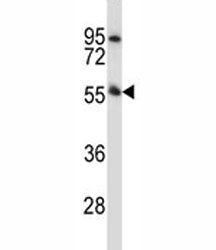 Pink1 antibody western blot analysis in mouse heart tissue lysate. Predicted molecular weight: 60-70 kDa.