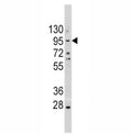 Western blot analysis of anti-E Cadherin antibody and A375 lysate. Expected molecular weight: 135 kDa (precursor), 80-120 kDa (mature, depending on gylcosylation level).