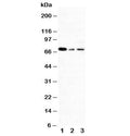 Western blot testing of XRCC1 antibody and Lane 1: 293T; 2: A431; 3: HeLa cell lysate. Rountinely observed molecular weight: 69~90 kDa.