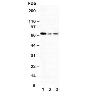 Western blot testing of XRCC1 antibody and Lane 1: 293T; 2: A431; 3: HeLa cell lysate. Rountinely observed molecular weight: 69~90 kDa.