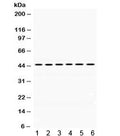 Western blot testing of 1) rat brain, 2) rat testis, 3) mouse brain, 4) human PANC, 5) human HeLa and 6) human MCF7 lysate with ARC antibody. Expected/observed molecular weight ~45 kDa.
