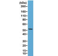Western blot of human HeLa lysate using recombinant CK7 antibody at 1:2500. Predicted molecular weight ~51 kDa.