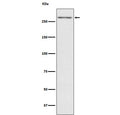Western blot testing with TG antibody. Predicted molecular weight ~305 kDa.