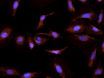 IHC testing of PFA-fixed and TX100-treated HeLa cells with CYP26A1 antibody at 2.5ug/ml (DAPI nuclear counterstaining in blue).