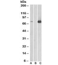 Western blot of HEK293 lysate overexpressing human MAP3K7/TAK1 with DYKDDDDK tag probed with TAK1 antibody [1ug/ml] in Lane A and probed with anti-DYKDDDDK tag (1/3000) in lane C. Mock-transfected HEK293 probed with TAK1 antibody [1ug/ml] in Lane B. Predicted molecular weight: 64-69 kDa, routinely observed at 78-82 kDa.