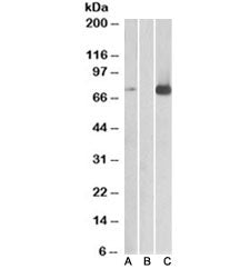 Western blot of HEK293 lysate overexpressing human MAP3K7/TAK1 with DYKDDDDK tag probed with TAK1 antibody [1ug/ml] in Lane A and probed with anti-DYKDDDDK tag (1/3000) in lane C. Mock-transfected HEK293 probed with TAK1 antibody [1ug/ml] in Lane B. Predicted molecular weight: 64-69 kDa, routinely observed at 78-82 kDa.