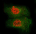 Immunofluorescent staining of FFPE human A549 cells with MED7 antibody (red) and Beta Tubulin mAb (green). HIER: steam section in pH6 citrate buffer for 20 min.