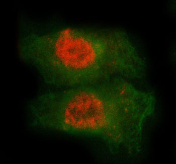 Immunofluorescent staining of FFPE human A549 cells with MED7 antibody (red) and Beta Tubulin mAb (green). HIER: steam section in pH6 citrate buffer for 20 min.